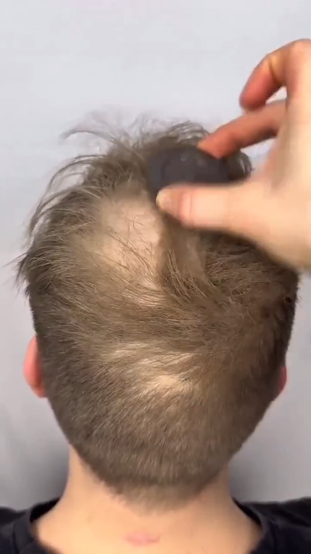 Vidéo résultat client